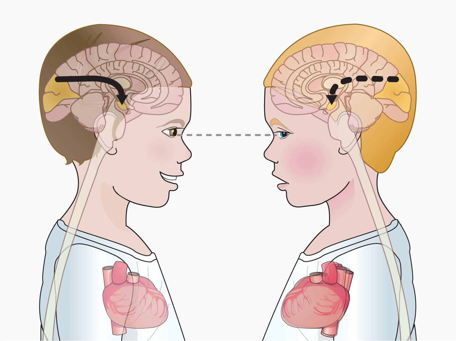 Autism and mirror neurons