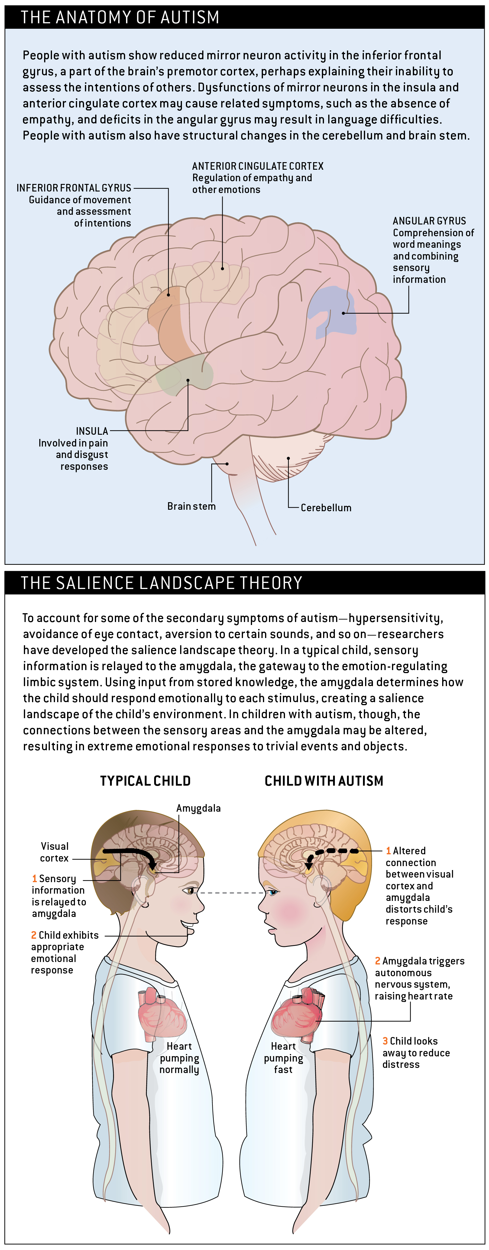 AutismTheory