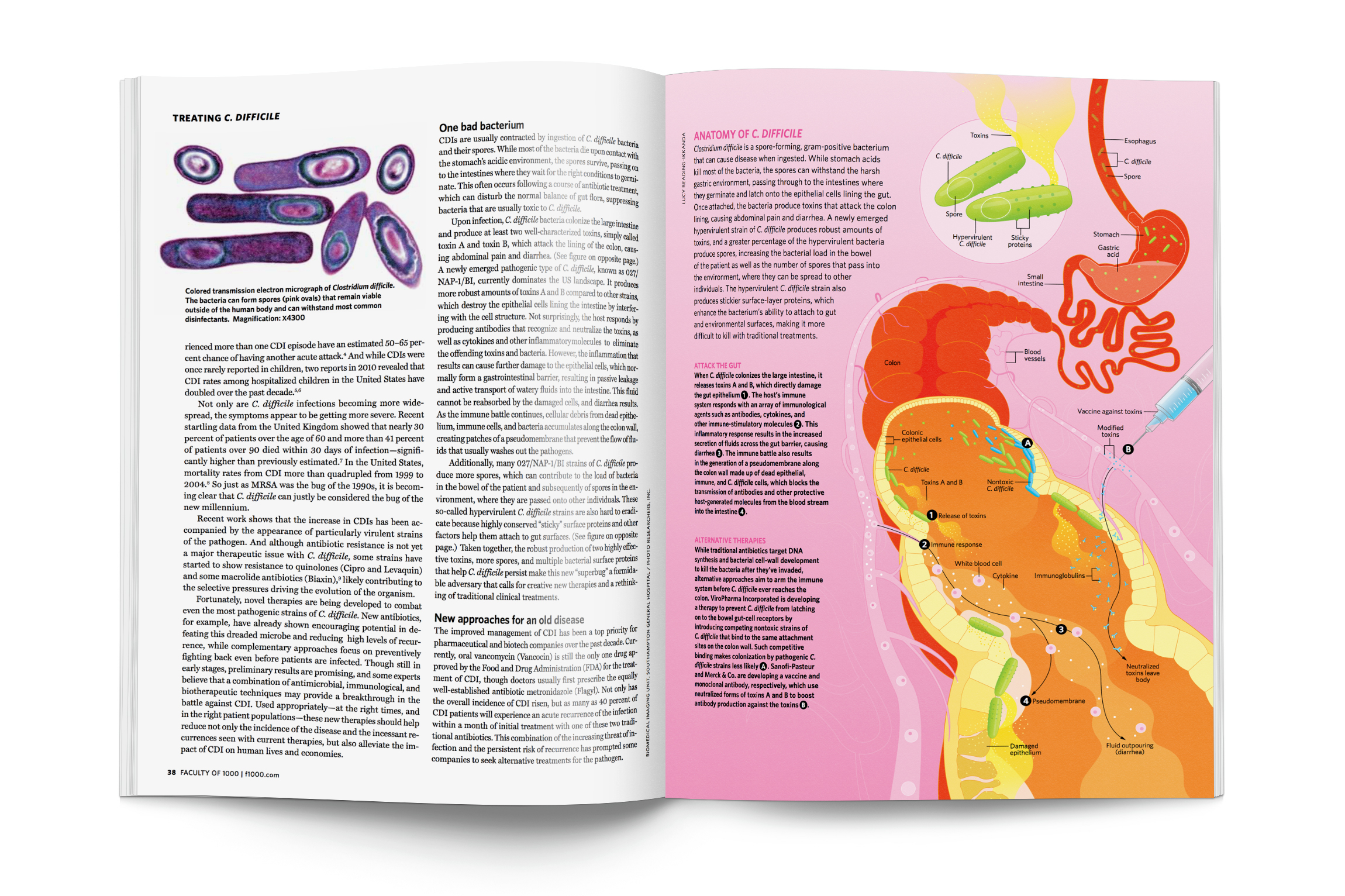Anatomy of C. Difficile