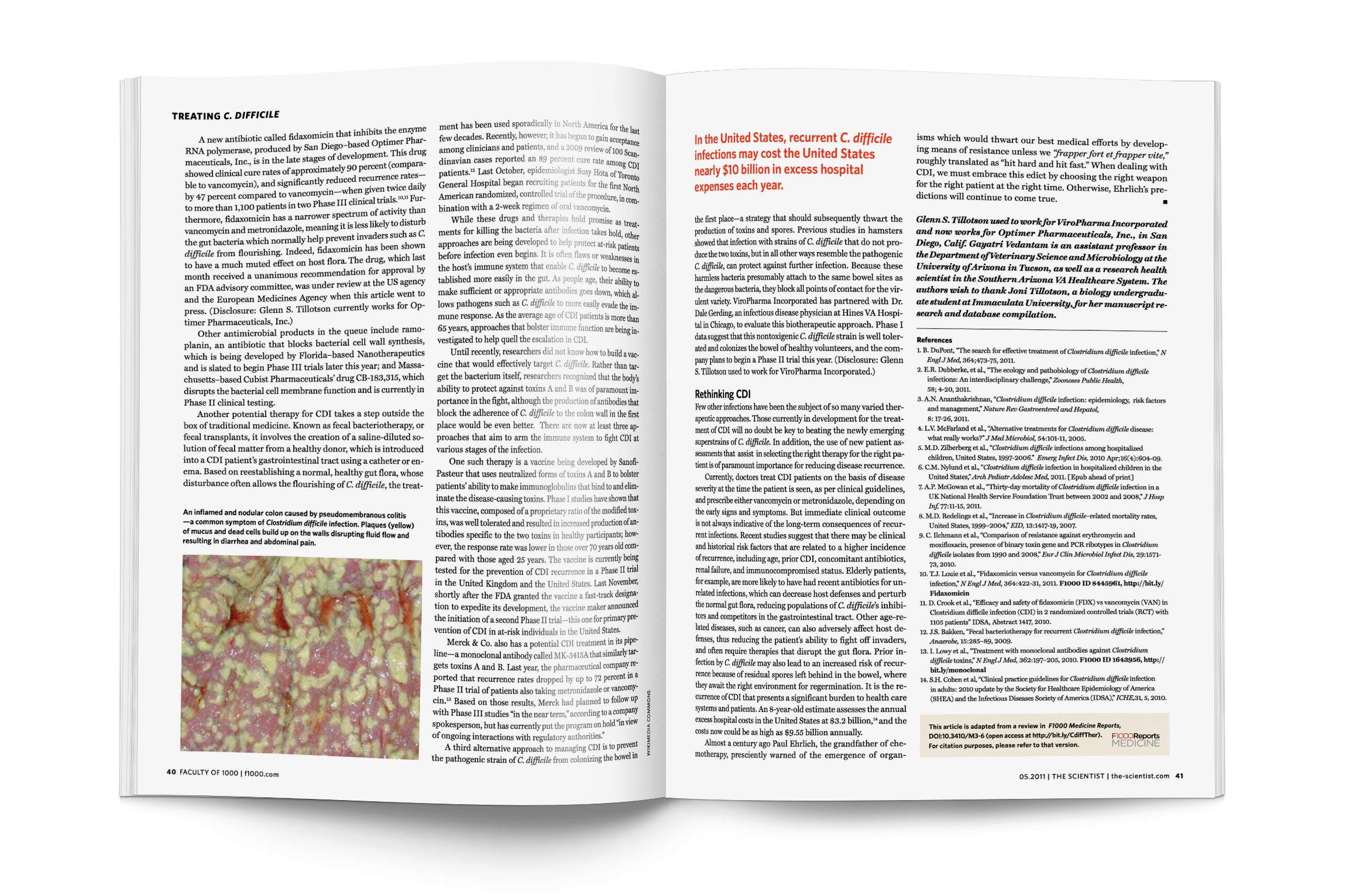 Anatomy of C. Difficile